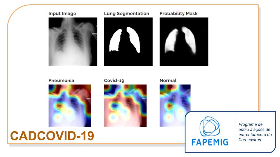 Diagnosis Aid Using Chest X-Ray and Deep Learning